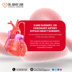 heart surgeon mumbai